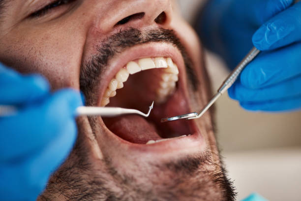Best Urgent Care for Lost Fillings or Crowns in Roanoke Rapids, NC